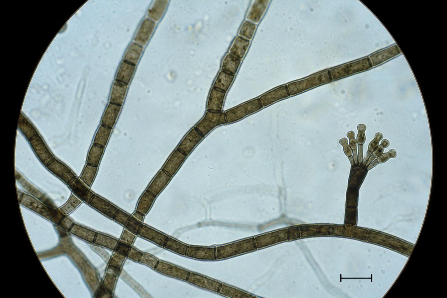 Stacky Botriss Stachybotrys Microscopy — Microscopy — Mycelia