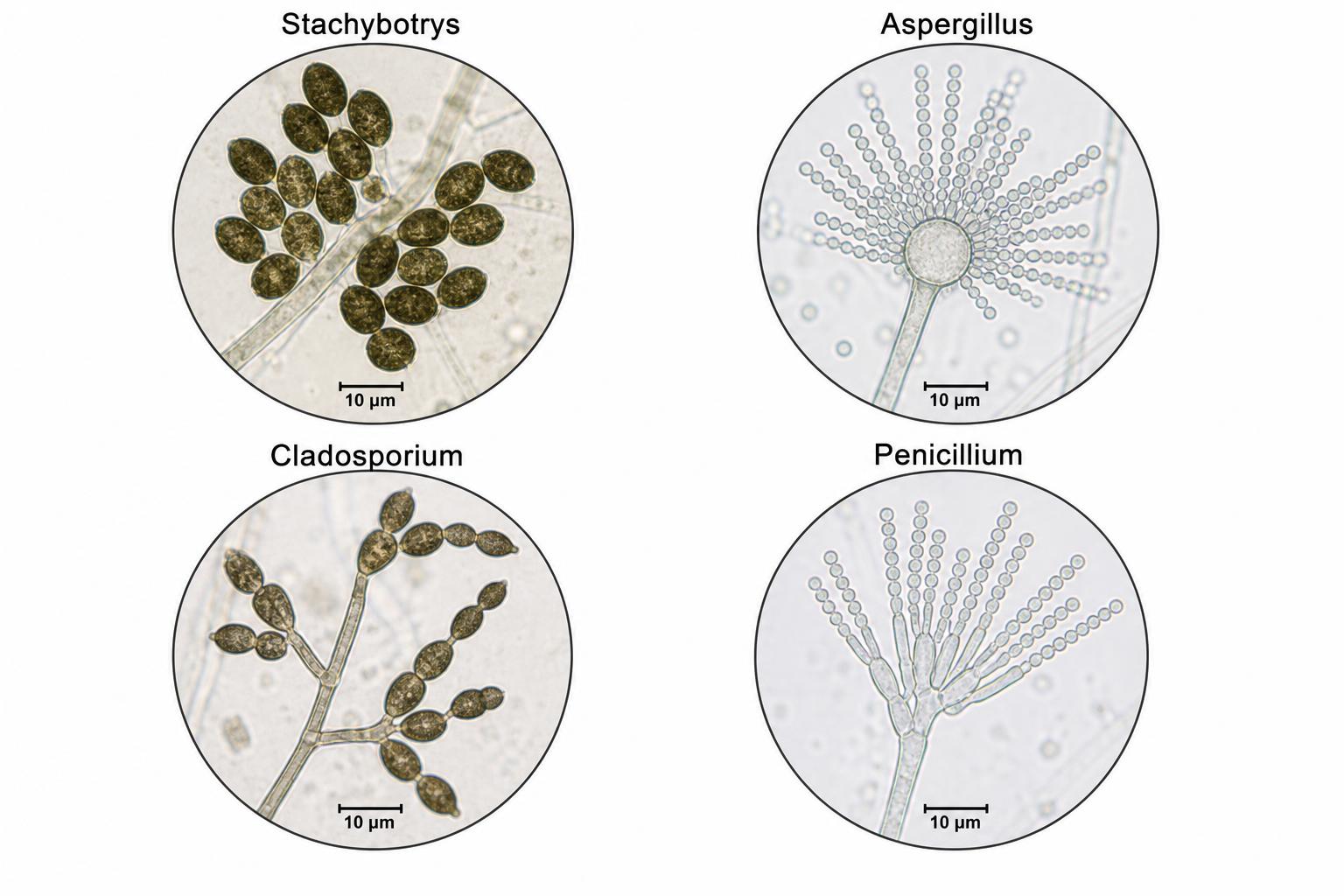 Stacky Botriss Stachybotrys Microscopy — Microscopy — Mycelia